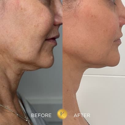 Kane Medical Aesthetics