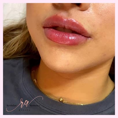 Revitalize Aesthetics MedSpa Ltd.