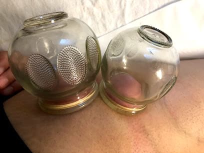 Acupuncture Natural Healing