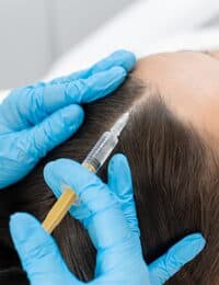 Alopécie - Traitement des cheveux Et PRP